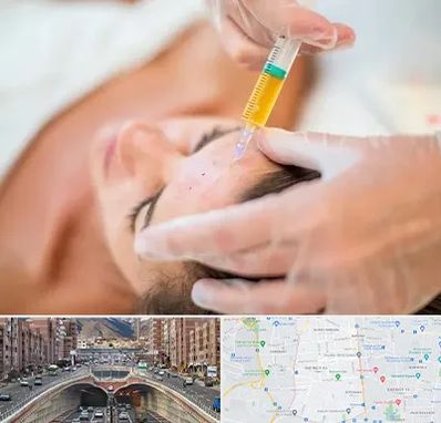 پی آر پی در منطقه 10 تهران 