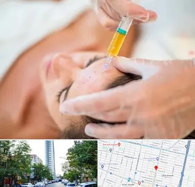 پی آر پی در امامت مشهد