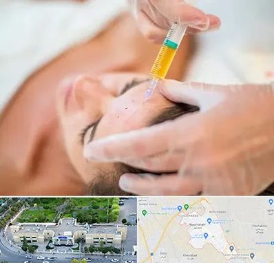 پی آر پی در نسیم شهر