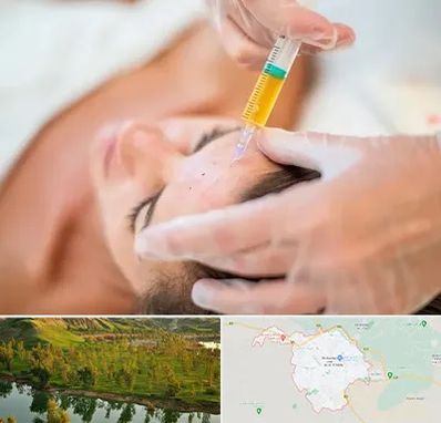 پی آر پی در بهبهان