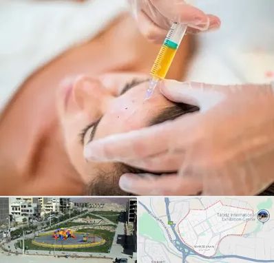 پی آر پی در مرزداران تبریز