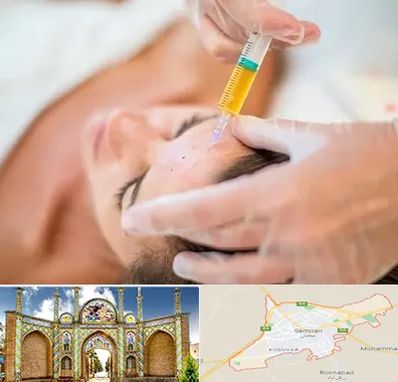 پی آر پی در سمنان