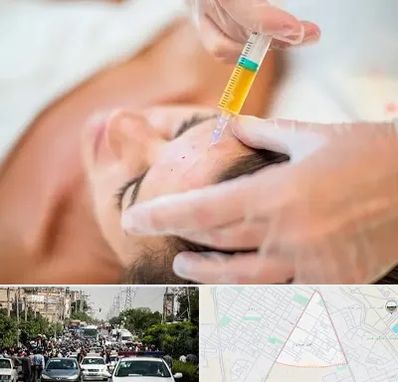 پی آر پی در سیدی مشهد