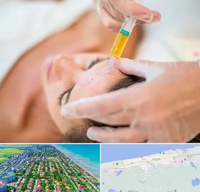 پی آر پی در فریدونکنار