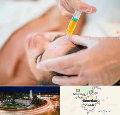 پی آر پی در همدان