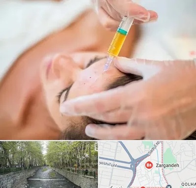 پی آر پی در زرگنده