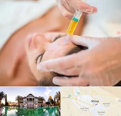 پی آر پی در شیراز