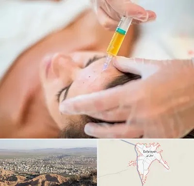 پی آر پی در اسفراین