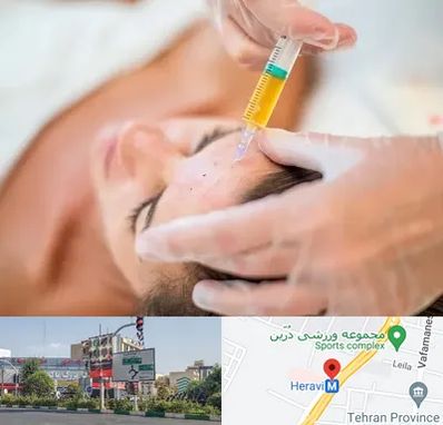 پی آر پی در هروی 