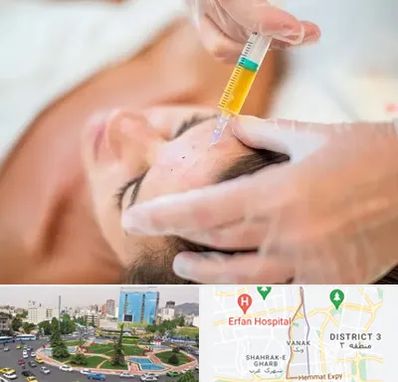 پی آر پی در ونک 