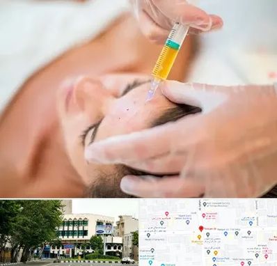 پی آر پی در طالقانی 