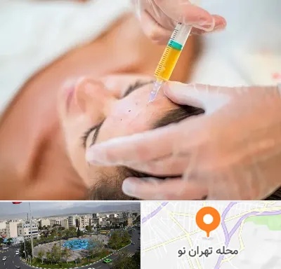 پی آر پی در تهران نو