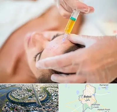 پی آر پی در بابل