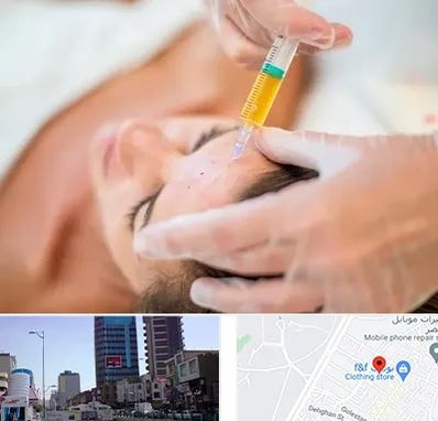 پی آر پی در چهارراه طالقانی کرج