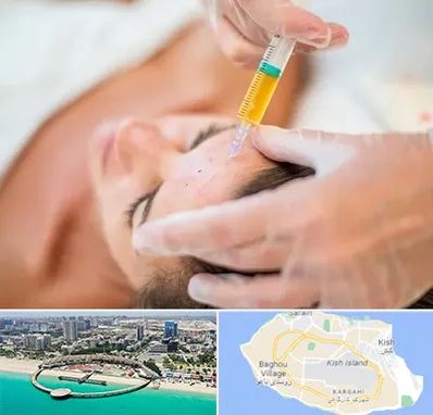 پی آر پی در کیش