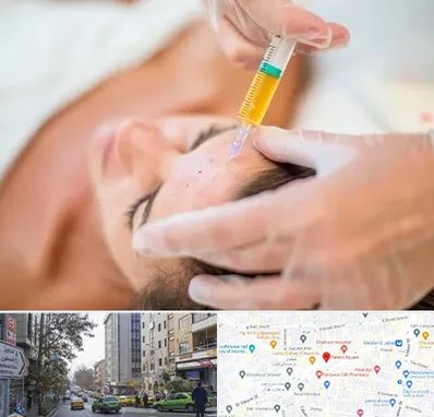 پی آر پی در فاطمی 