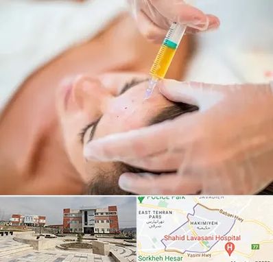 پی آر پی در حکیمیه 