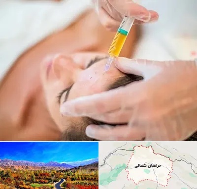 پی آر پی در خراسان شمالی