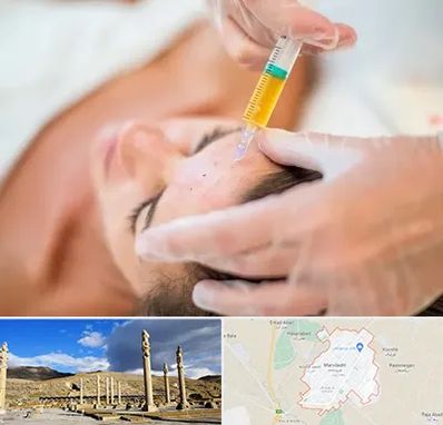 پی آر پی در مرودشت