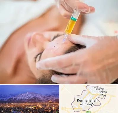 پی آر پی در کرمانشاه