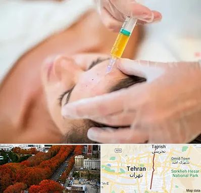 پی آر پی در ولیعصر 