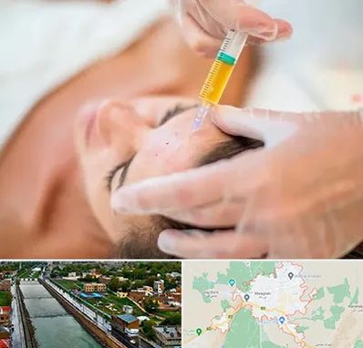 پی آر پی در مراغه