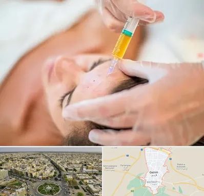 پی آر پی در قزوین