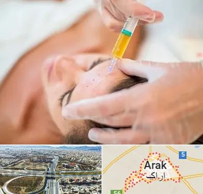 پی آر پی در اراک