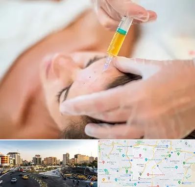 پی آر پی در منطقه 7 تهران 