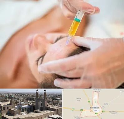 پی آر پی در سبزوار