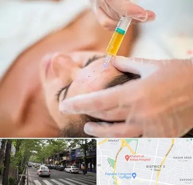 پی آر پی در ظفر 