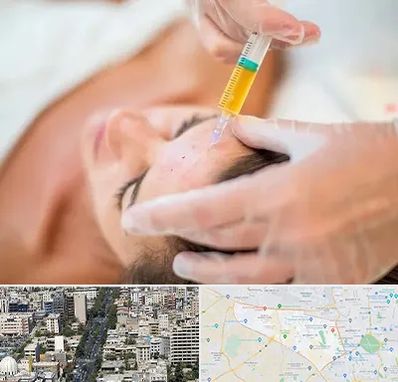 پی آر پی در منطقه 18 تهران 