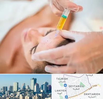 پی آر پی در قیطریه 