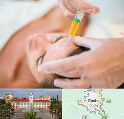 پی آر پی در رشت