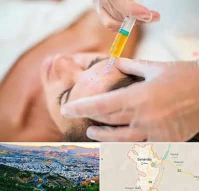 پی آر پی در سنندج