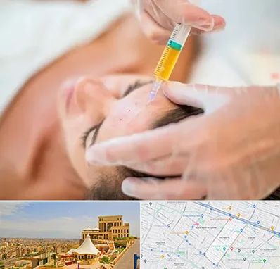 پی آر پی در هاشمیه مشهد