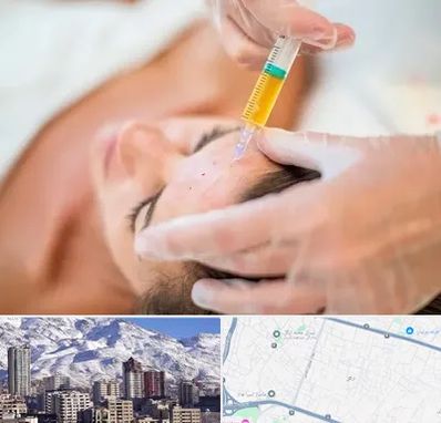 پی آر پی در ازگل