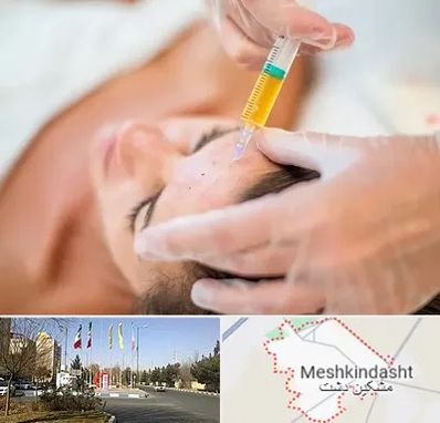 پی آر پی در مشکین دشت