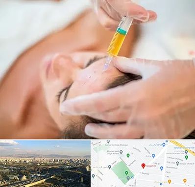 پی آر پی در هنگام 