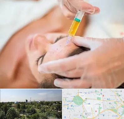 پی آر پی در منطقه 16 تهران 