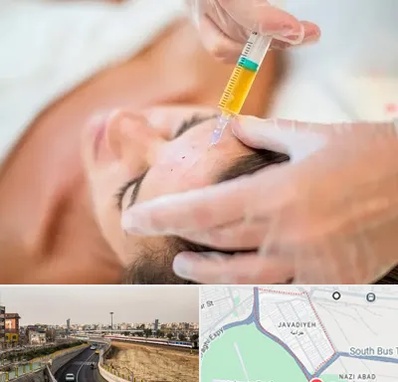 پی آر پی در جوادیه