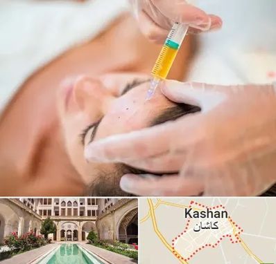 پی آر پی در کاشان