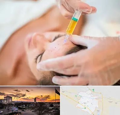 پی آر پی در قوچان