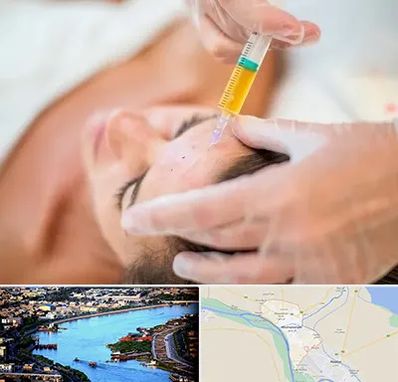 پی آر پی در خرمشهر