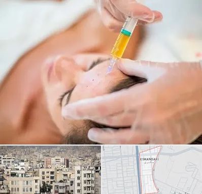 پی آر پی در اسکندری