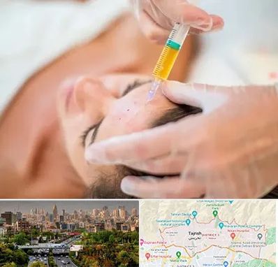 پی آر پی در منطقه 1 تهران 