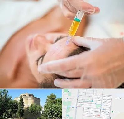 پی آر پی در مرداویج اصفهان