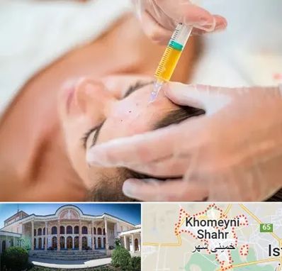 پی آر پی در خمینی شهر