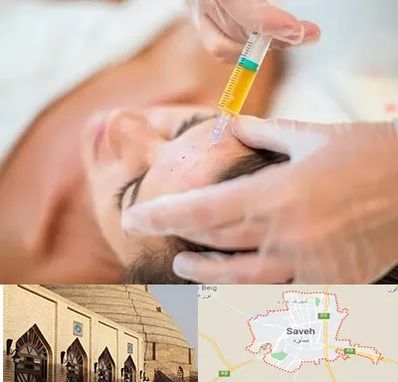 پی آر پی در ساوه