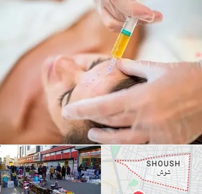 پی آر پی در شوش